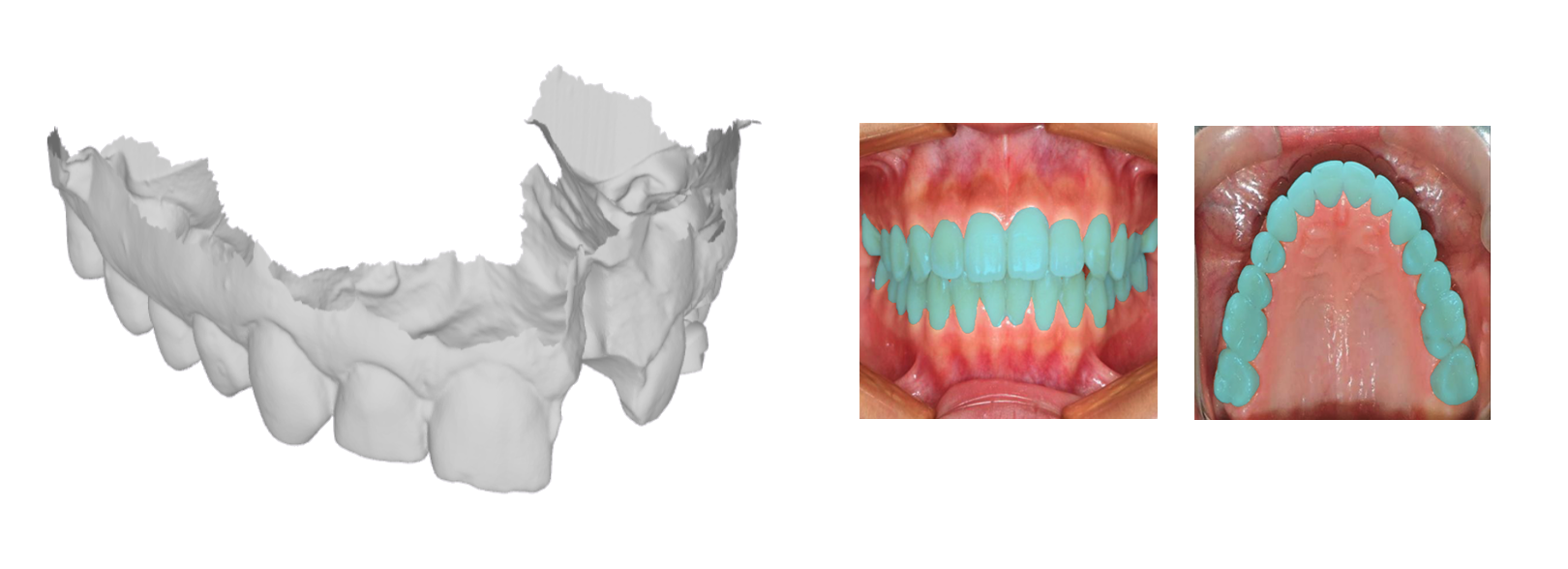 We also specialize in the processing of dental data from 3D scans and 2D photographs, with capabilities ranging from 6D pose estimation for individual tooth localization and instance segmentation to the generation of synthetic training datasets.